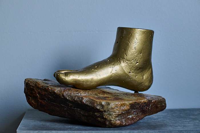 Before Thomas lost his leg, an uncle took a plaster casting of his about-to-be-amputated foot.